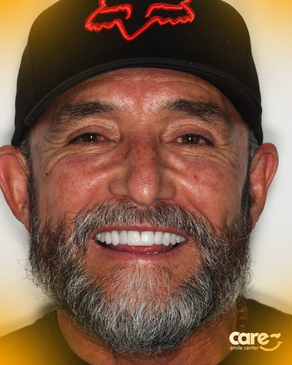 Slider image (3) Care Smile Center